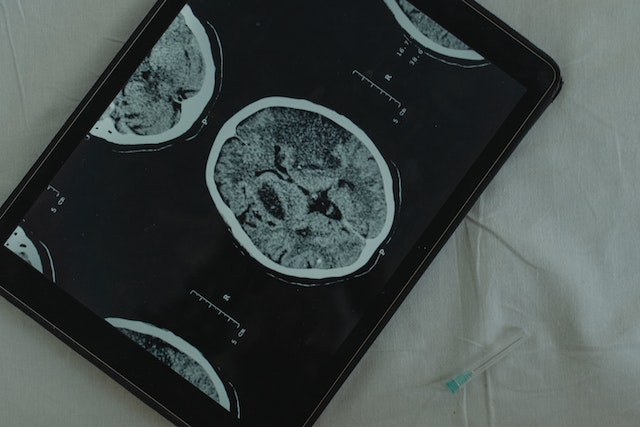 Scan on brain displayed on tablet